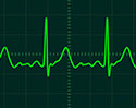 นักวิจัยไอเดียเจ๋ง นำคลื่นไฟฟ้าหัวใจ (ECG) มาใช้เป็น Password ปกป้องฐานข้อมูลคนไข้ ยืนยันปลอมยากกว่าลายนิ้วมือหลายเท่า